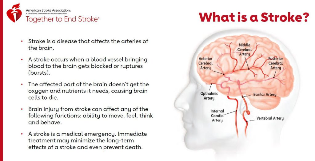 What is a Stroke from the American Stroke Association